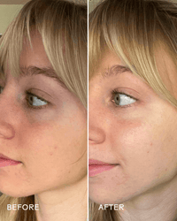 Before and after results from Brighter Days Eye Mask — reduces puffiness and brightens eyes
